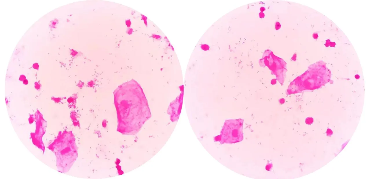 1750819298797729.jpg f2fa31d1441192e4929c01248e8e5089.jpg